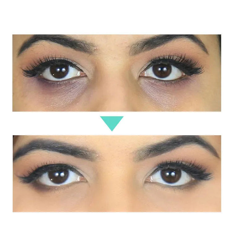 30ml Beauty Eye Cream tube with hyaluronic acid for dark circles and puffiness