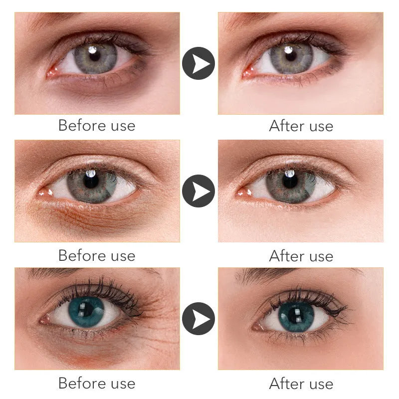 30ml Beauty Eye Cream tube with hyaluronic acid for dark circles and puffiness