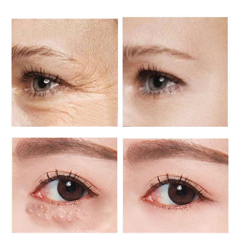 30ml Beauty Eye Cream tube with hyaluronic acid for dark circles and puffiness